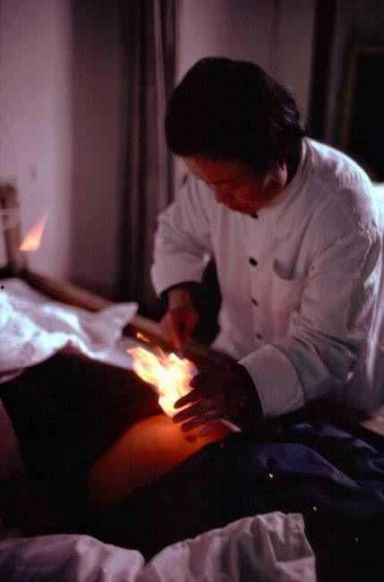 老中医做针灸视频爆料 第1张 老中医做针灸视频爆料 第1张